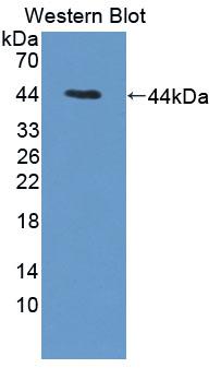 Polyclonal Antibody to Cathepsin W (CTSW)
