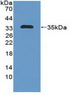 Polyclonal Antibody to Microtubule Associated Protein 1B (MAP1B)