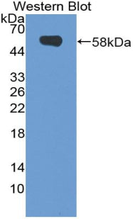 Polyclonal Antibody to Neuropilin 2 (NRP2)