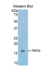 Polyclonal Antibody to Low Density Lipoprotein Receptor Related Protein Associated Protein 1 (LRPAP1)