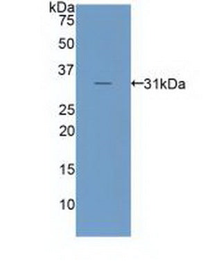 Polyclonal Antibody to Low Density Lipoprotein Receptor Related Protein 6 (LRP6)