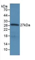 Polyclonal Antibody to Ribonuclease L (RNASEL)