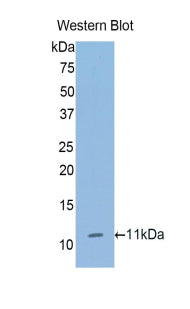 Polyclonal Antibody to Collagen Type II Alpha 1 (COL2a1)