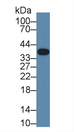 Polyclonal Antibody to Troponin T Type 1, Slow Skeletal (TNNT1)