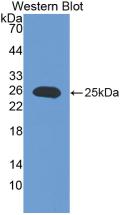 Polyclonal Antibody to Interleukin 17 Receptor E (IL17RE)