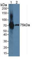Polyclonal Antibody to Interleukin 17 Receptor E (IL17RE)