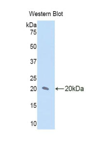 Polyclonal Antibody to Interleukin 17 Receptor D (IL17RD)