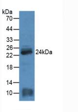 Polyclonal Antibody to Myosin Light Chain 4, Alkali, Atrial, Embryonic (MYL4)