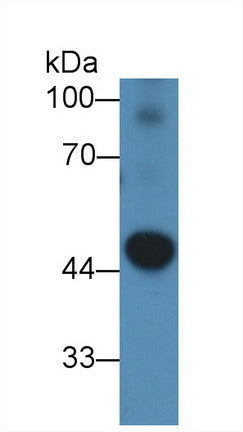 Polyclonal Antibody to Pyruvate Dehydrogenase Kinase Isozyme 2 (PDK2)