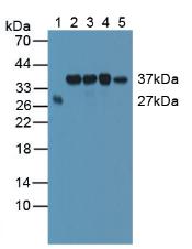 Polyclonal Antibody to Survival Of Motor Neuron 2, Centromeric (SMN2)