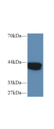 Polyclonal Antibody to Isovaleryl Coenzyme A Dehydrogenase (IVD)