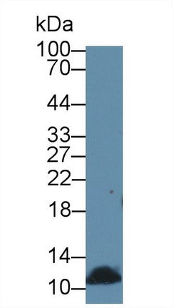 Polyclonal Antibody to Diazepam Binding Inhibitor (DBI)