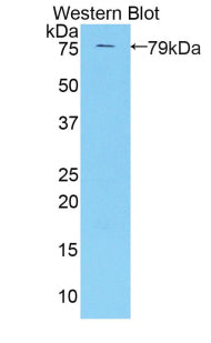 Polyclonal Antibody to Killer Cell Immunoglobulin Like Receptor 3DL3 (KIR3DL3)