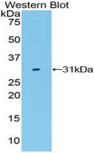 Polyclonal Antibody to Low Density Lipoprotein Receptor Related Protein 3 (LRP3)