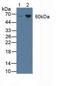 Polyclonal Antibody to Asparagine Synthetase (ASNS)