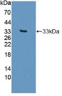 Polyclonal Antibody to Phospholipase C Beta 2 (PLCb2)