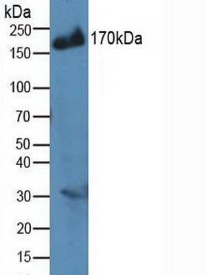 Polyclonal Antibody to Insulin Receptor Substrate 2 (IRS2)