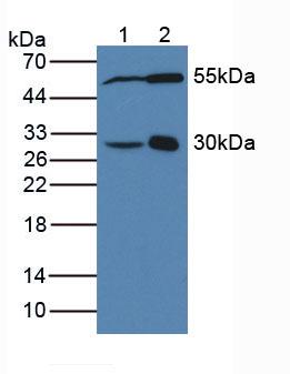 Polyclonal Antibody to Dimethylarginine Dimethylaminohydrolase 2 (DDAH2)