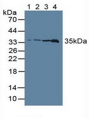 Polyclonal Antibody to Lactate Dehydrogenase C (LDHC)