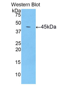 Polyclonal Antibody to Lipocalin 8 (LCN8)