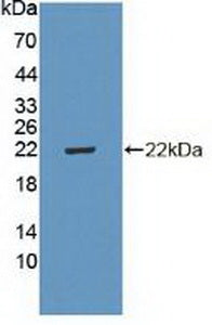 Polyclonal Antibody to Cyclin Dependent Kinase Inhibitor 2D (CDKN2D)