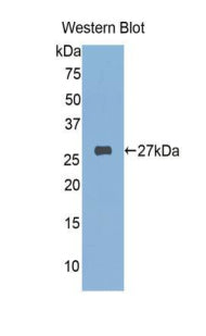 Polyclonal Antibody to FK506 Binding Protein 3 (FKBP3)
