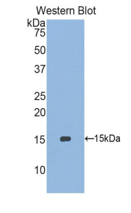 Polyclonal Antibody to Selenoprotein X1 (SEPX1)