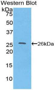 Polyclonal Antibody to Torsin 2A (TOR2A)