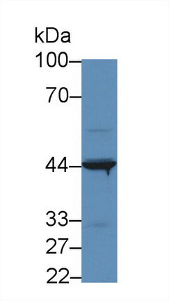 Polyclonal Antibody to Interleukin 31 Receptor A (IL31RA)