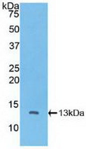 Polyclonal Antibody to Catenin Beta Interacting Protein 1 (CTNNbIP1)