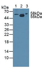 Polyclonal Antibody to Anthrax Toxin Receptor 2 (ANTXR2)