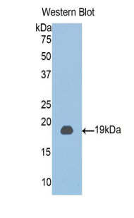 Polyclonal Antibody to Chloride Intracellular Channel Protein 4 (CLIC4)
