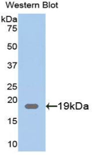 Polyclonal Antibody to Chloride Intracellular Channel Protein 4 (CLIC4)