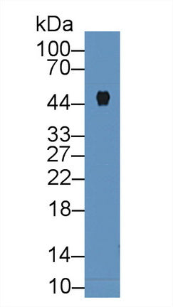 Polyclonal Antibody to Carboxypeptidase B1, Tissue (CPB1)