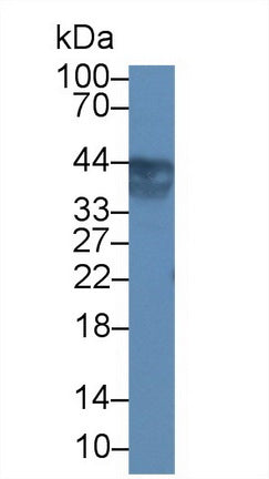 Polyclonal Antibody to Uroplakin 3A (UPK3A)