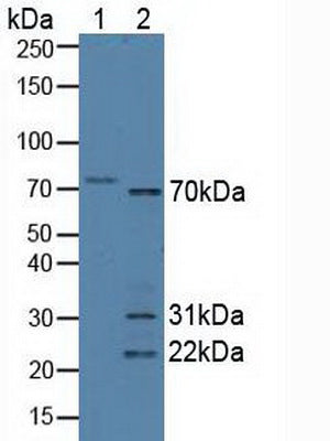 Polyclonal Antibody to Syncoilin (SYNC)