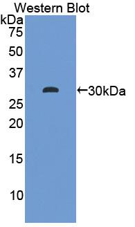 Polyclonal Antibody to Hydroxyacid Oxidase 1 (HAO1)