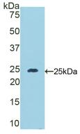 Polyclonal Antibody to Desmocollin 1 (DSC1)
