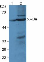 Polyclonal Antibody to Lysophosphatidylcholine Acyltransferase 3 (LPCAT3)