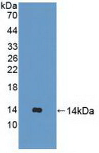 Polyclonal Antibody to Ubiquilin 2 (UBQLN2)