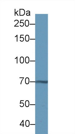 Polyclonal Antibody to Transketolase (TKT)