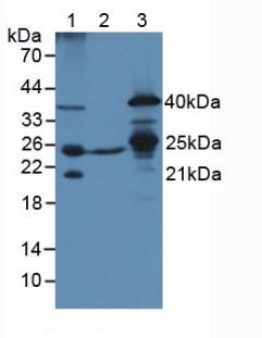 Polyclonal Antibody to Transcription Factor A, Mitochondrial (TFAM)