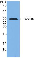 Polyclonal Antibody to Stratifin (SFN)