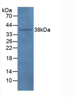 Polyclonal Antibody to Paraneoplastic Antigen MA2 (PNMA2)