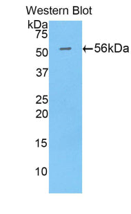 Polyclonal Antibody to Plastin 3 (PLS3)