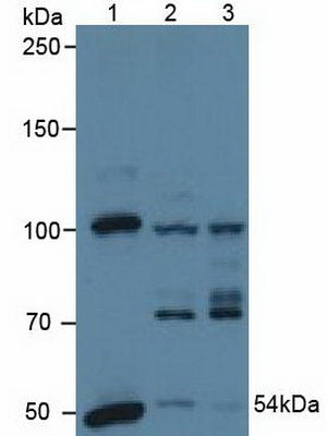 Polyclonal Antibody to Pyruvate Dehydrogenase Complex Component X (PDHX)