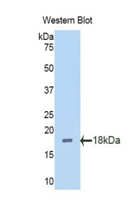 Polyclonal Antibody to Polybromo 1 (PBRM1)