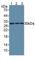 Polyclonal Antibody to Nicotinamide-N-Methyltransferase (NNMT)