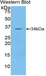 Polyclonal Antibody to Never In Mitosis Gene A Related Kinase 2 (NEK2)