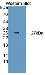 Polyclonal Antibody to Interleukin 1 Receptor Accessory Protein Like Protein 2 (IL1RAPL2)
